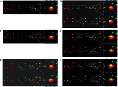 ColocZStats: a z-stack signal colocalization extension tool for 3D slicer